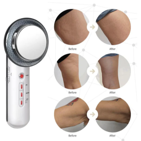 3-in-1 UltraBody Slimming Device